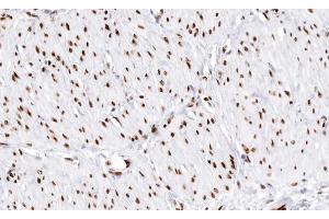 ABIN6266717 at 1/100 staining human muscle tissue sections by IHC-P.