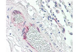 Anti-PTGIS antibody IHC of human lung, vessel. (PTGIS anticorps  (AA 475-490))