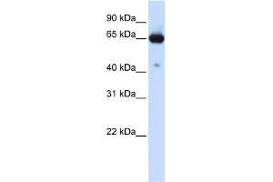 WB Suggested Anti-SLC39A4 Antibody Titration:  0.