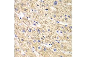 Immunohistochemistry of paraffin-embedded human liver injury using ACADS antibody at dilution of 1:100 (x40 lens). (ACADS anticorps)