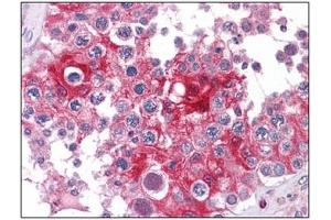 Immunohistochemistry (IHC) image for anti-Lactate Dehydrogenase A (LDHA) antibody (ABIN614512) (Lactate Dehydrogenase A anticorps)