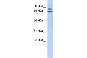 WB Suggested Anti-FSIP1 Antibody Titration: 0. (FSIP1 anticorps  (Middle Region))