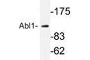 Western blot analyzes of Abl1 antibody in extracts from K562 cells. (ABL1 anticorps)