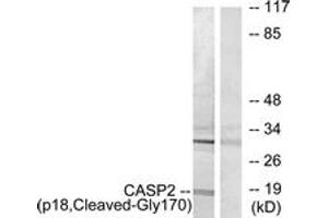 Western Blotting (WB) image for anti-Caspase 2, Apoptosis-Related Cysteine Peptidase (CASP2) (AA 151-200), (Cleaved-Gly170) antibody (ABIN2891170) (Caspase 2 anticorps  (Cleaved-Gly170))