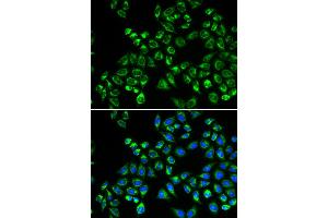 Immunofluorescence analysis of HeLa cells using C1QBP antibody. (C1QBP anticorps)