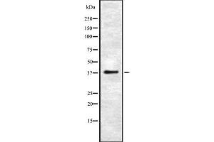Western blot analysis UCHL5 using HeLa whole cell lysates (UCHL5 anticorps  (Internal Region))