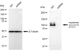 Western blotting analysis using Amyloid beta precursor like protein 2 antibody (ABIN7797595). (Recombinant APLP2 anticorps)
