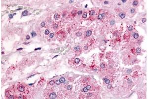 anti-G Protein-Coupled Receptor 182 (GPR182) (Extracellular Domain) antibody