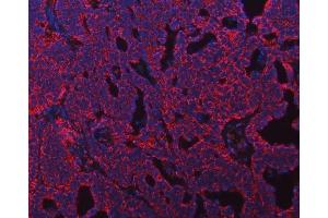 IF analysis of ATP5F1B using anti-ATP5F1B antibody (ABIN7599866). (Atp5f1b (AA 123-529) anticorps)