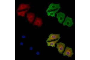 ABIN6258194 and ABIN6273898 staining Hela cells by IF/ICC. (GPR83 anticorps  (N-Term))