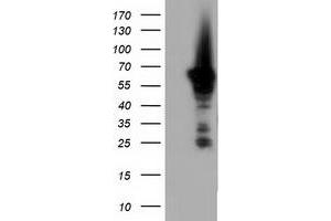 Western Blotting (WB) image for anti-Adenylate Kinase 5 (AK5) antibody (ABIN1496534) (Adenylate Kinase 5 anticorps)