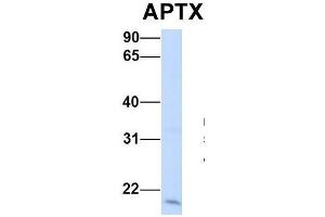 Host:  Rabbit  Target Name:  APTX  Sample Type:  Human 293T  Antibody Dilution:  1. (Aprataxin anticorps  (Middle Region))