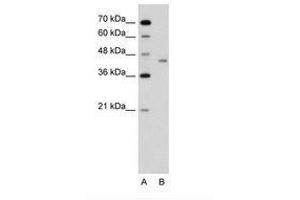Image no. 1 for anti-LRP2 Binding Protein (LRP2BP) (AA 151-200) antibody (ABIN6736640) (LRP2BP anticorps  (AA 151-200))