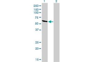 Western Blot analysis of RIOK3 expression in transfected 293T cell line by RIOK3 monoclonal antibody (M02), clone 3G11.