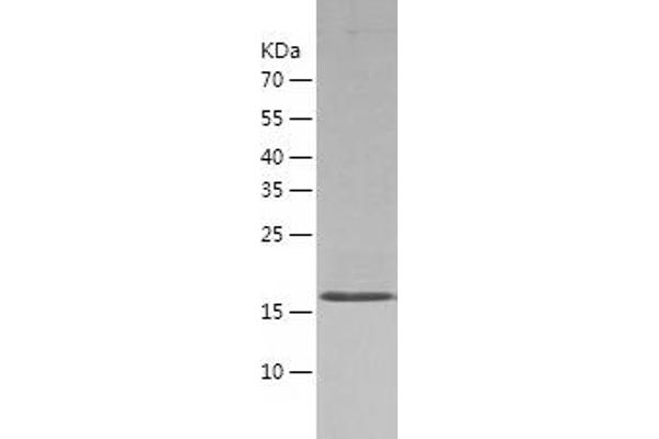 PGLYRP1 Protein (AA 22-196) (His-IF2DI Tag)