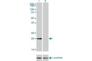Western blot analysis of CSRP3 over-expressed 293 cell line, cotransfected with CSRP3 Validated Chimera RNAi (Lane 2) or non-transfected control (Lane 1).