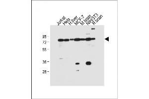All lanes : Anti-NUR77 (NR4A1) Antibody  at 1:500 dilution Lane 1: Jurkat whole cell lysate Lane 2: Hela whole cell lysate Lane 3: Human liver tissue lysate Lane 4: MCF-7 whole cell lysate Lane 5: Mouse brain tissue lysate Lane 6: NIH/3T3 whole cell lysate Lane 7: Rat brain tissue lysate Lysates/proteins at 20 μg per lane.