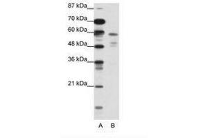 Image no. 1 for anti-Nuclear Receptor Subfamily 1, Group H, Member 3 (NR1H3) (N-Term) antibody (ABIN202546)