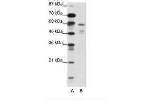 Image no. 1 for anti-Nuclear Receptor Subfamily 1, Group H, Member 3 (NR1H3) (N-Term) antibody (ABIN202546) (NR1H3 anticorps  (N-Term))