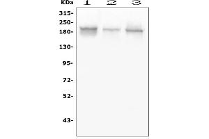 Western blot analysis of GLI2 using anti-GLI2 antibody (ABIN6719569).