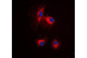 Immunofluorescent analysis of MRPL15 staining in HuvEc cells. (MRPL15 anticorps  (Center))
