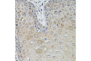 Immunohistochemistry of paraffin-embedded human esophagus using MMP9 antibody (ABIN5998248) at dilution of 1/100 (40x lens). (MMP 9 anticorps)