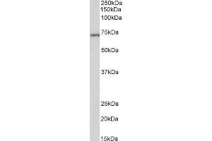 ABIN2613488 (2µg/ml) staining of Daudi lysate (35µg protein in RIPA buffer). (TICAM1 anticorps  (Internal Region))