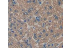 IHC-P analysis of Mouse Tissue, with DAB staining. (HSD17B10 anticorps  (AA 4-202))