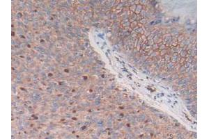 Figure. (S100A14 anticorps  (AA 1-91))