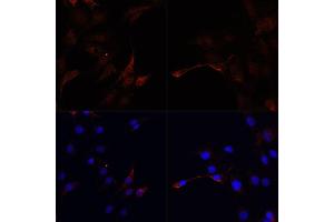 Immunofluorescence analysis of C6 cells using MAP1LC3B antibody (ABIN1876926) at dilution of 1:100. (LC3B anticorps)