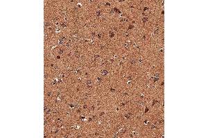 Immunohistochemical analysis of paraffin-embedded human brain tissue using (ABIN657909 and ABIN2846858) performed on the Leica® BOND RXm.