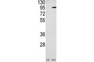 Western blot analysis APP antibody and 293 cell lysate (2 ug/lane) either nontransfected (Lane 1) or transiently transfected with the APP gene (2). (APP anticorps  (AA 29-61))