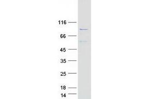 Validation with Western Blot