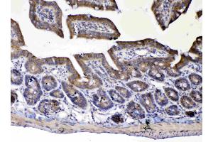 IHC analysis of UGT1A1 using anti-UGT1A1 antibody .