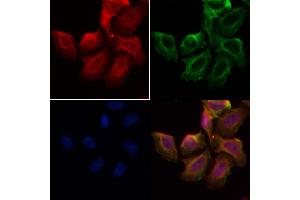 ABIN6258322 and ABIN6274167 staining Hela by IF/ICC.
