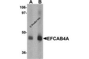 Western Blotting (WB) image for anti-EF-Hand Calcium Binding Domain 4A (EFCAB4A) (Middle Region) antibody (ABIN1030922) (EFCAB4A anticorps  (Middle Region))