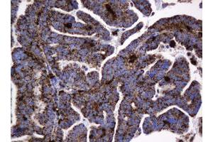 Image no. 10 for anti-Galactosidase, beta 1 (GLB1) antibody (ABIN1498467)