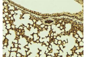 ABIN6273265 at 1/100 staining Mouse lung tissue by IHC-P.