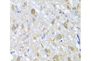 Immunohistochemistry of paraffin-embedded Rat brain using BNIP3L Polyclonal Antibody at dilution of 1:100 (40x lens).