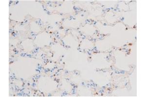 ABIN6267603 at 1/200 staining Rat lung tissue sections by IHC-P.