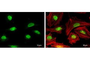 ICC/IF Image Rad51 antibody [N1C2] detects Rad51 protein at nucleus by immunofluorescent analysis. (RAD51 anticorps  (Center))