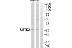 Western blot analysis of extracts from HuvEc cells and COLO cells, using UBTD2 antibody.