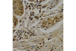 Immunohistochemistry of paraffin-embedded human normal stomach using UMPS antibody at dilution of 1:200 (400x lens).