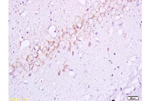 Formalin-fixed and paraffin embedded rat brain tissue labeled with Anti BETA(TYR1345) Polyclonal Antibody,Unconjugated (ABIN747128) at 1:200 followed by conjugation to the secondary antibody and DAB staining. (ISR-beta anticorps  (pTyr1355))