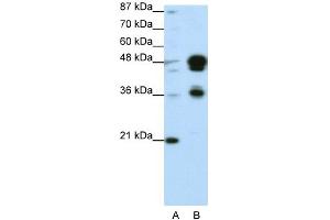 WB Suggested Anti-FOXA1 Antibody Titration: 0.