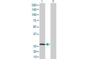 Western Blot analysis of PSPH expression in transfected 293T cell line by PSPH monoclonal antibody (M01), clone 3A5.