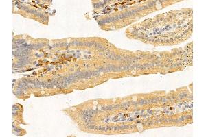 ABIN7094769 and ABIN7098820 at 1/100 staining Mouse stomach tissue by IHC-P. (PRMT3 anticorps  (Internal Region))