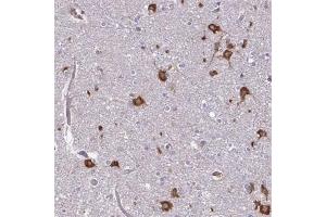 Immunohistochemical staining (Formalin-fixed paraffin-embedded sections) of human cerebral cortex with FMR1 polyclonal antibody  shows strong cytoplasmic positivity in neuronal cells at 1:200 - 1:500 dilution. (FMR1 anticorps)