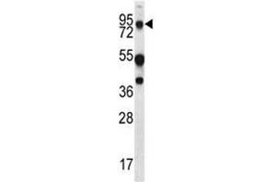 MUC20 antibody western blot analysis in WiDr lysate. (MUC20 anticorps  (AA 654-684))