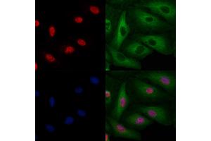 ABIN6263454 and ABIN6269077 staining  cells by IF/ICC.